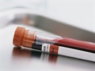 Product Showcase: Blood Gas Analyzers