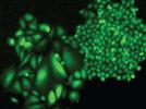 Image-Based Cell Analysis in Microplates