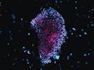 Cellular Reprogramming: Opportunities and Challenges