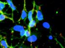 Image Analysis of Neurite Branching: High-Content Screening at High Speed