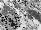 Subcellular Protein Localization With High Resolution: The Next Step in Proteomics