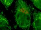 Microscopy is Moving On