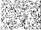 Particle Image Analysis: Microscopy Takes a Technological Leap Forward