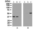 Selective Enrichment of Cytoskeleton-Associated Proteins for Detailed Protein Biochemical Analysis