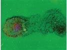 Matrix Degradation Assays for Investigating Cell Invasion