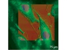 New Atomic Force Microscopy (AFM) Approaches Life Sciences Gently, Quantitatively, and Correlatively