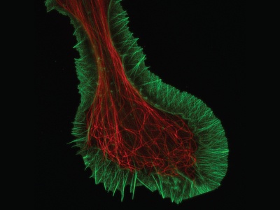 Super-Resolution Microscopy Helps Extend Optical Observation Beyond Its Theoretical Boundaries