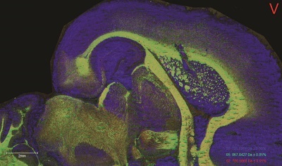 Tech Intelligence: Imaging MS Technology