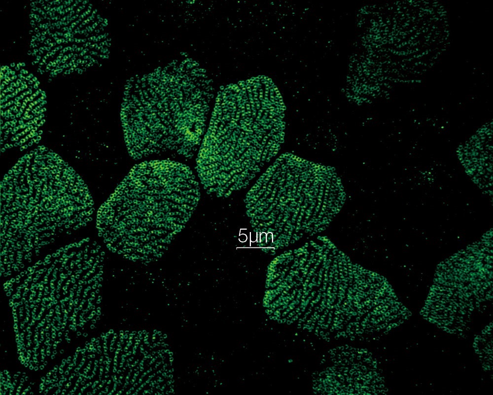 Beyond the Limit: The World of Super-Resolution Microscopy