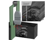 Ultrasonic Imaging of Traumatic Brain Injury (TBI)