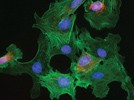 Fluorescence Microscopy: Solving Common Documentation Challenges