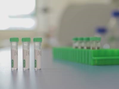  Bio-Rad Extends Range of Anti-Idiotypic Antibodies for Bioanalysis and Drug Monitoring