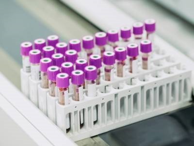  Buyer's Guide: Hematology Analyzers