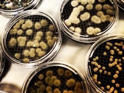  Membrane Filtration: Advantages and Modern Advancements