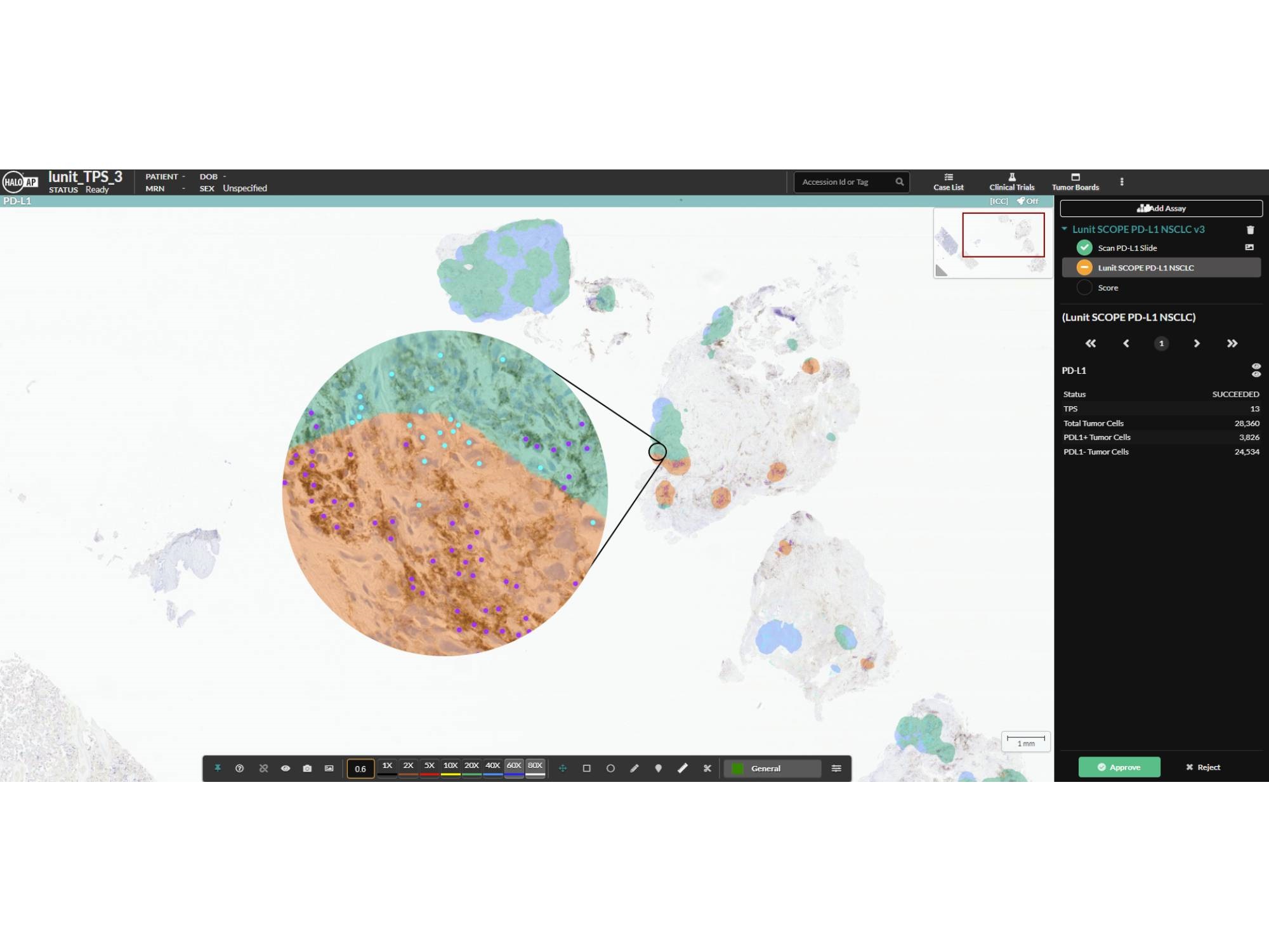 Indica Labs and Lunit Announce a Strategic Alliance for Seamless